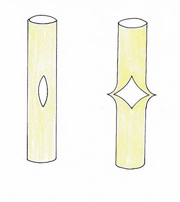 Aufspaltung des Neuralrohrs