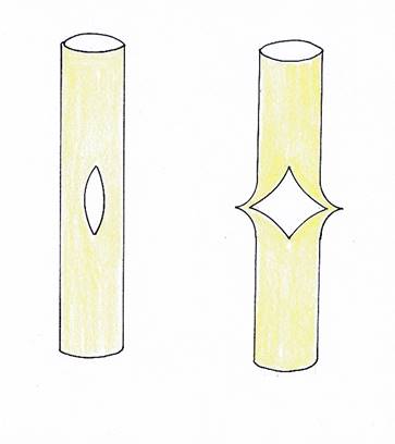 Aufspaltung des Neuralrohrs